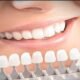 best teeth whitening kit